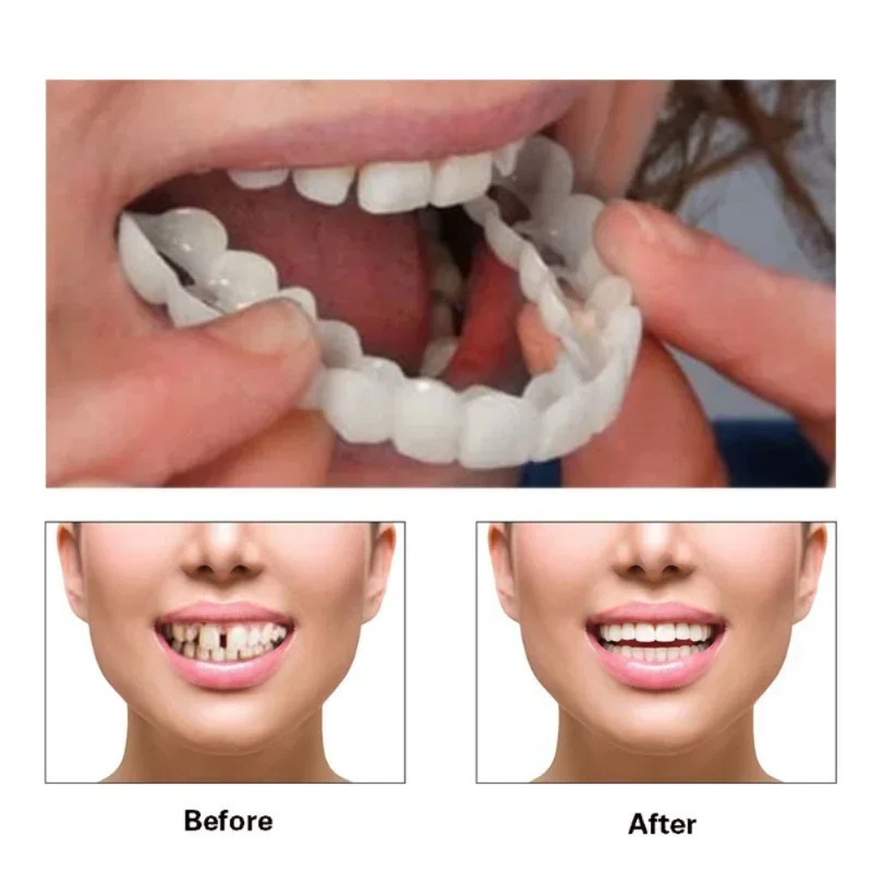 Teeth Whitening Mask - Perfect Fit Teeth Whitening Fake Tooth