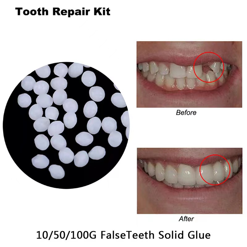 10g/bag Tooth Repair Kit-therm - Teeth Whitening Mask 评论和价格