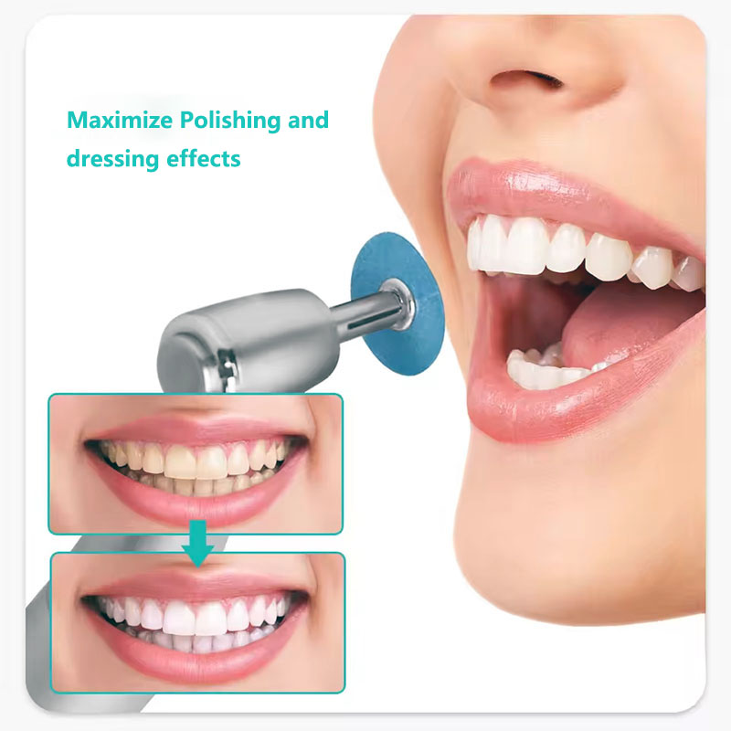 40pcs Dental Polishing Discs H - Teeth Whitening Home 评论和价格