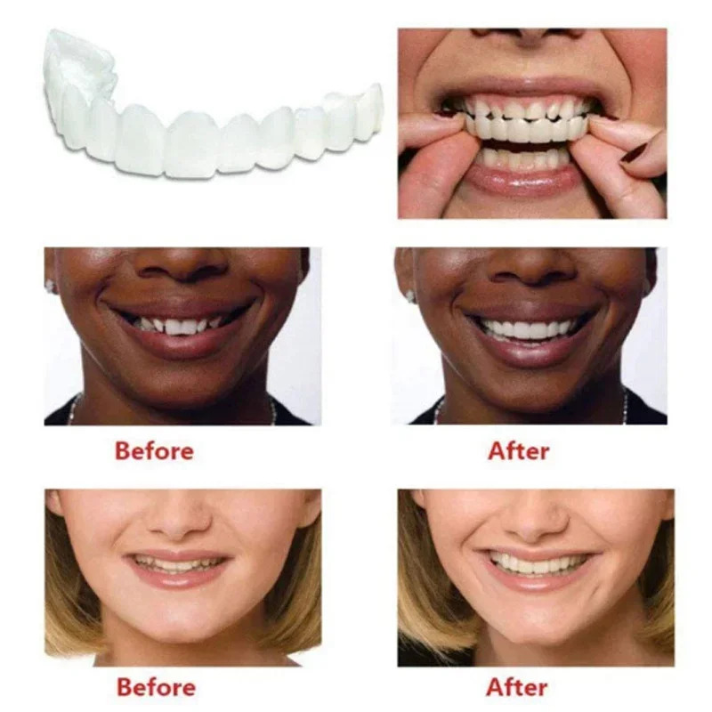 Perfect Fit Teeth Whitening Fa - Teeth Whitening Mask 评论和价格